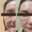 Antes y Después Bioestimuladores de Colágeno: Sculptra