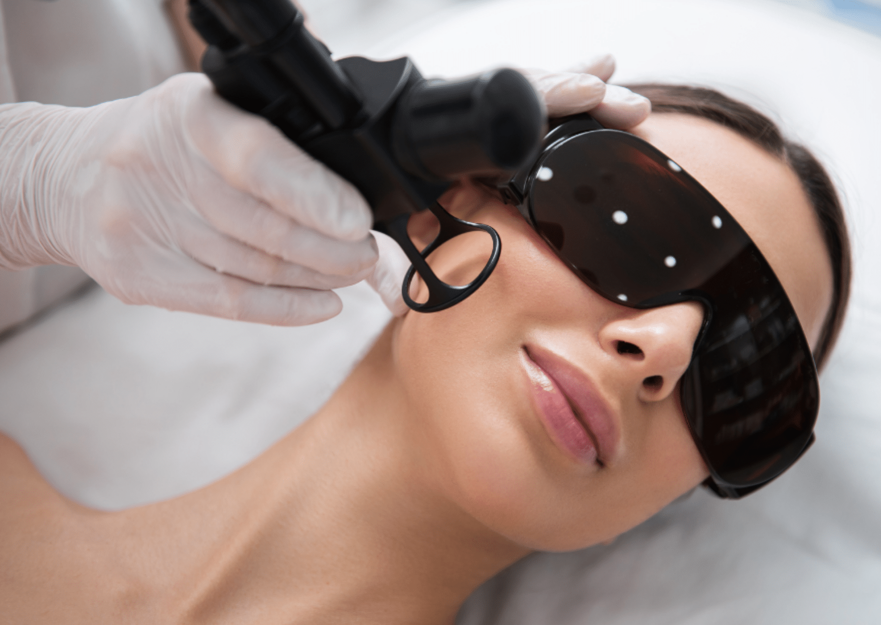 Rejuvenecimiento Facial con Láser CO₂ Fraccionado en Madrid