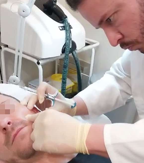 Sculptra: Contraindicaciones, Riesgos y Efectos Secundarios