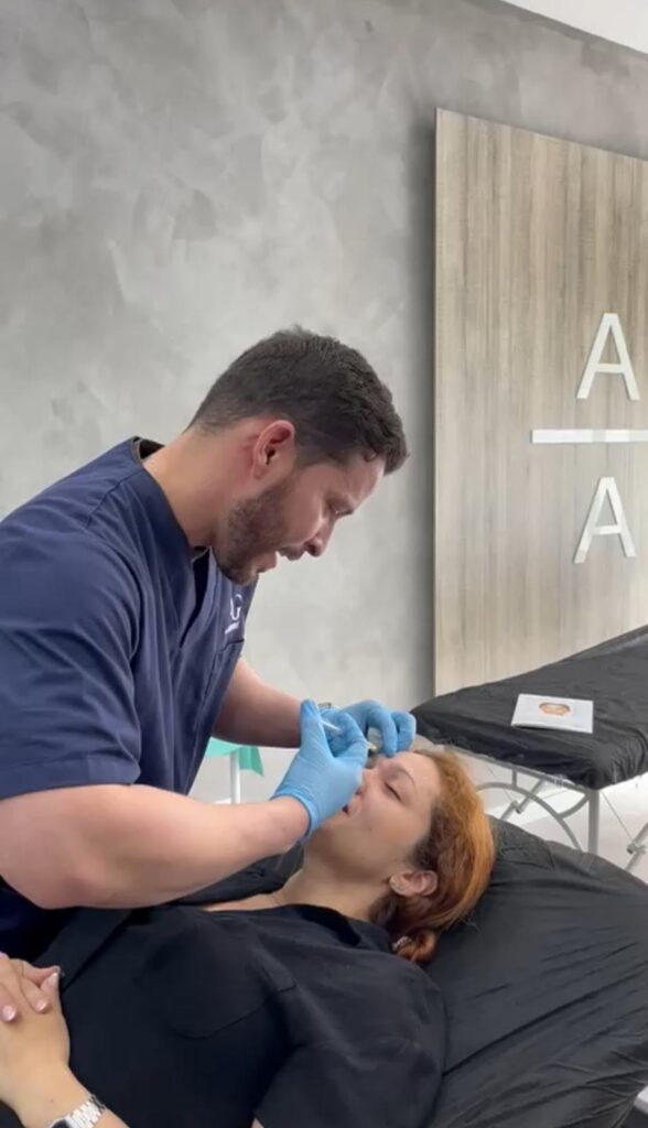 ematoma en los labios después del ácido hialurónico: Causas y cómo tratarlo