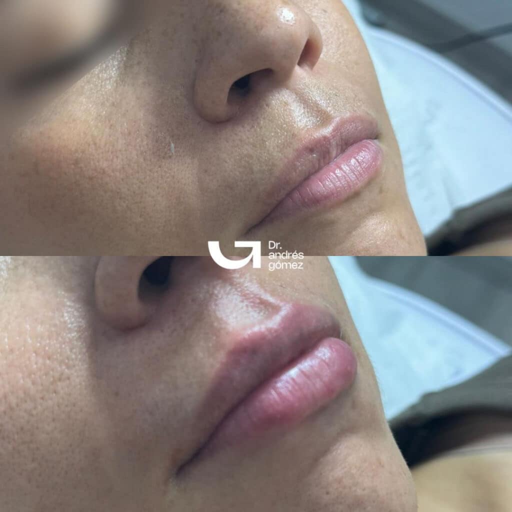 Labios Rusos en Madrid