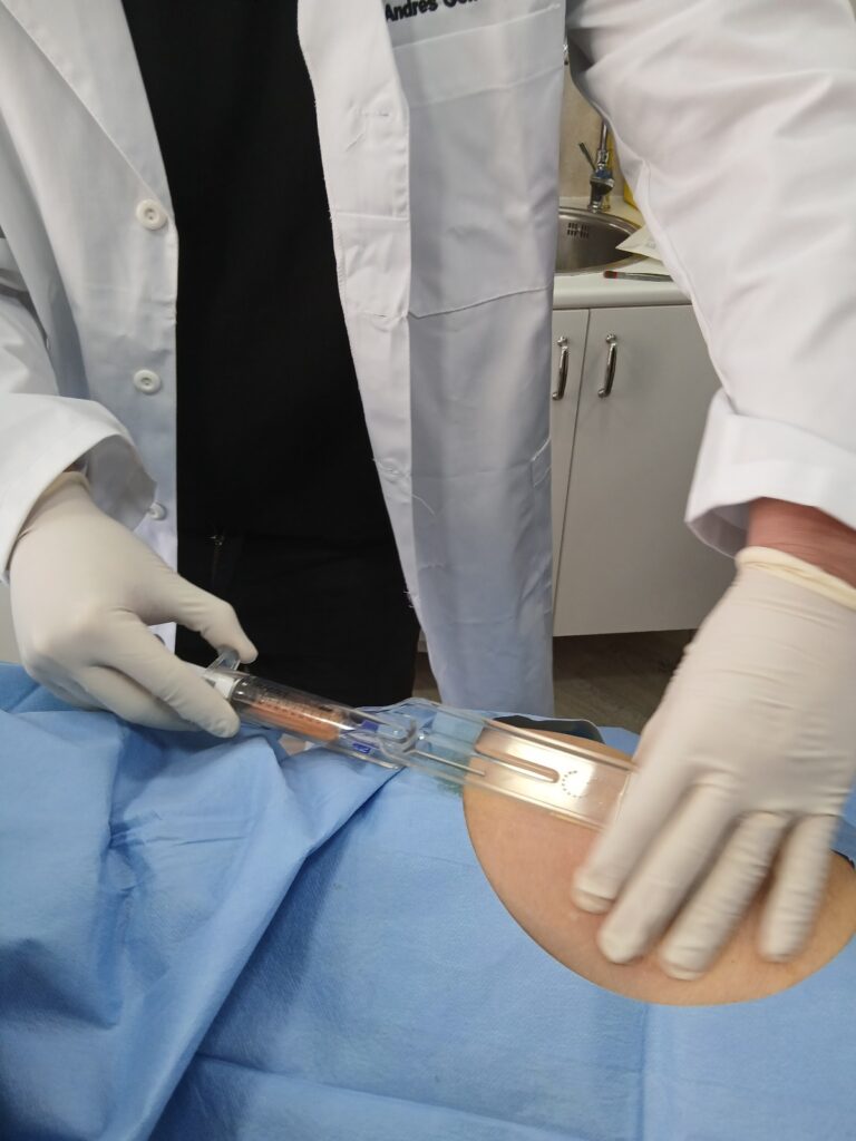 Terapia Regenerativa con Células Madre en Madrid