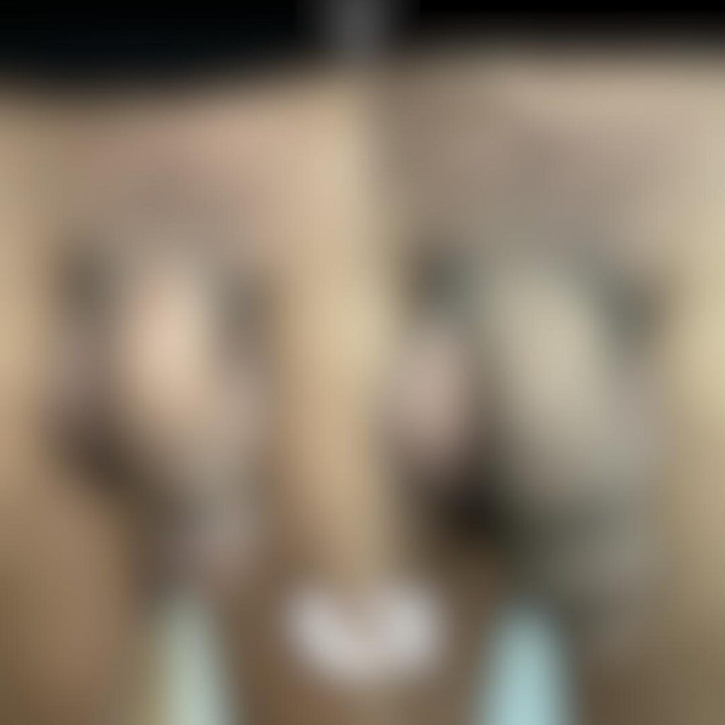 Engrosamiento de pene con Ácido hialurónico en Madrid