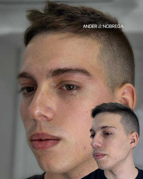 Resultado en consulta de micropigmentación de cejas y labios, caso 4. Fotografía completa facilitada para la web.