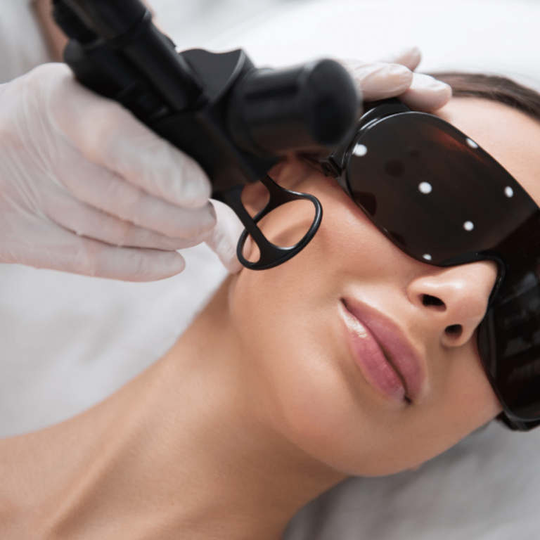 Rejuvenecimiento Facial con Láser CO₂ Fraccionado en Madrid