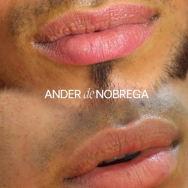 Labios hidratados y luminosos tras tratamiento con Dermapen, mostrando suavidad y naturalidad.