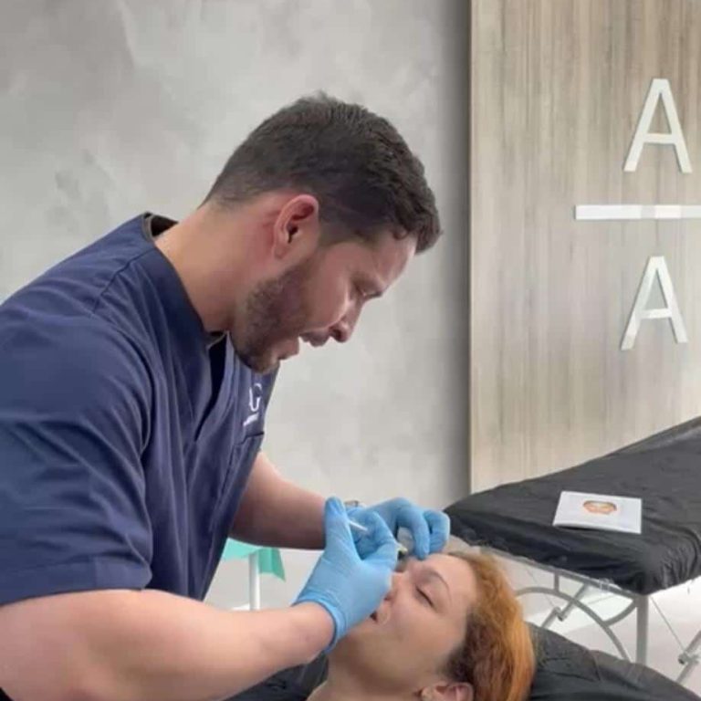 ematoma en los labios después del ácido hialurónico: Causas y cómo tratarlo