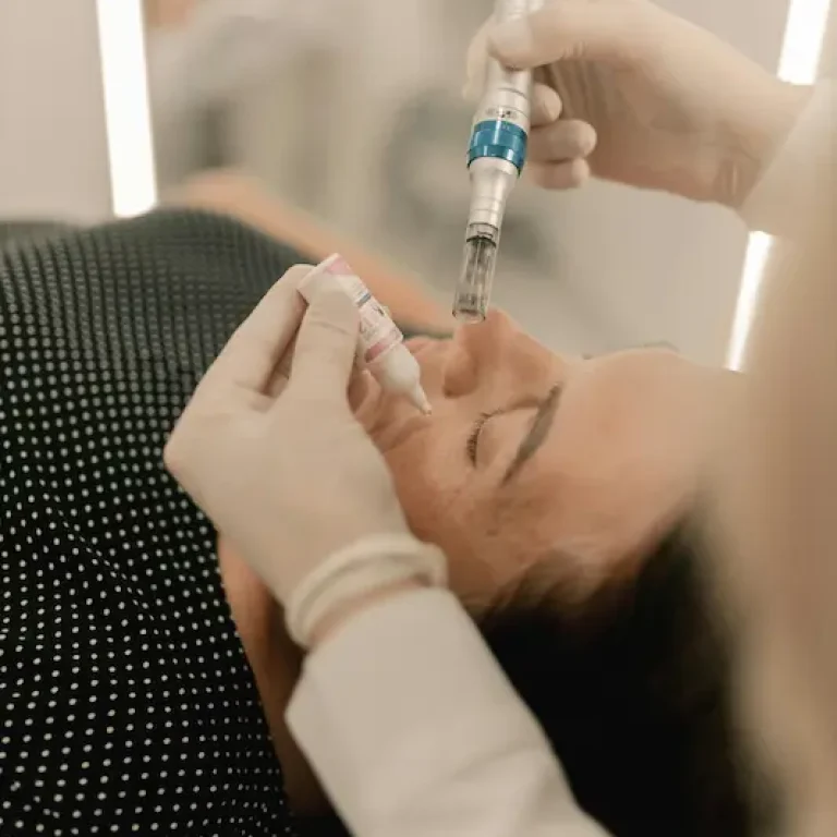 Sesión de tratamiento facial con Dermapen, enfocándose en el rejuvenecimiento de la piel.