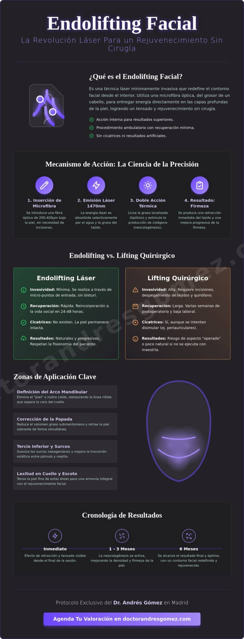 Endolifting Facial en Madrid: La Guía Definitiva del Rejuvenecimiento sin Cirugía en 2026