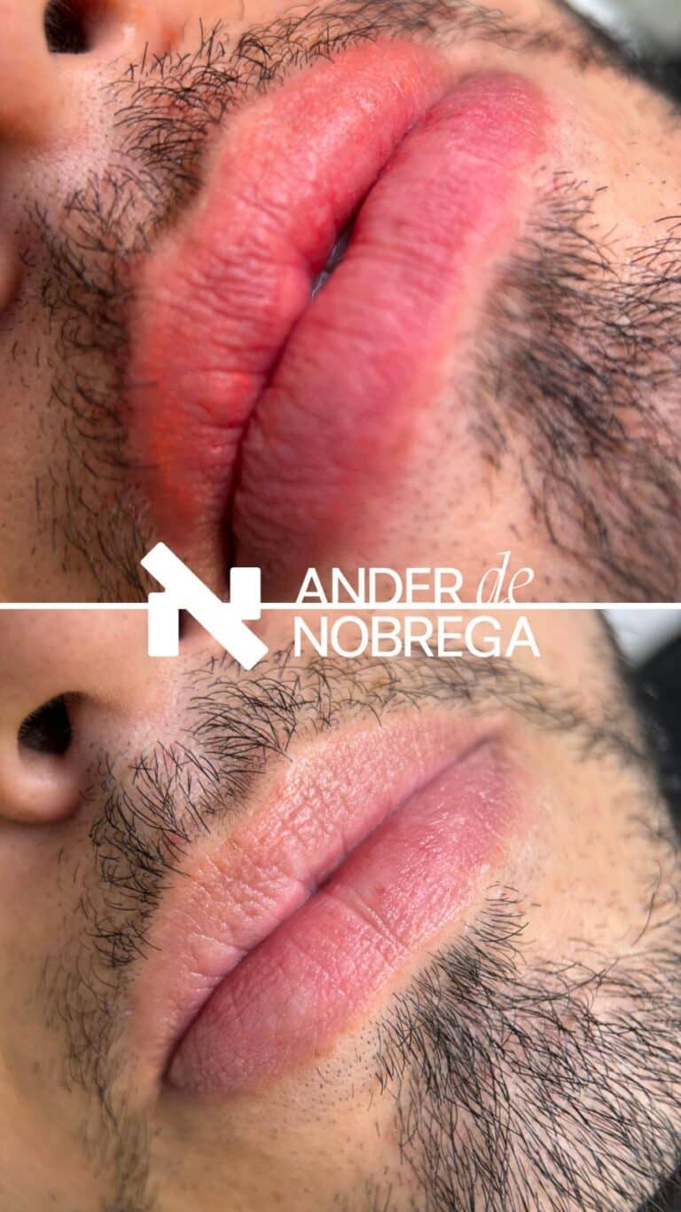 Especialistas en micropigmentación masculina en Madrid: técnicas avanzadas, pigmentos de alta calidad y protocolos seguros para resultados duraderos y naturales.