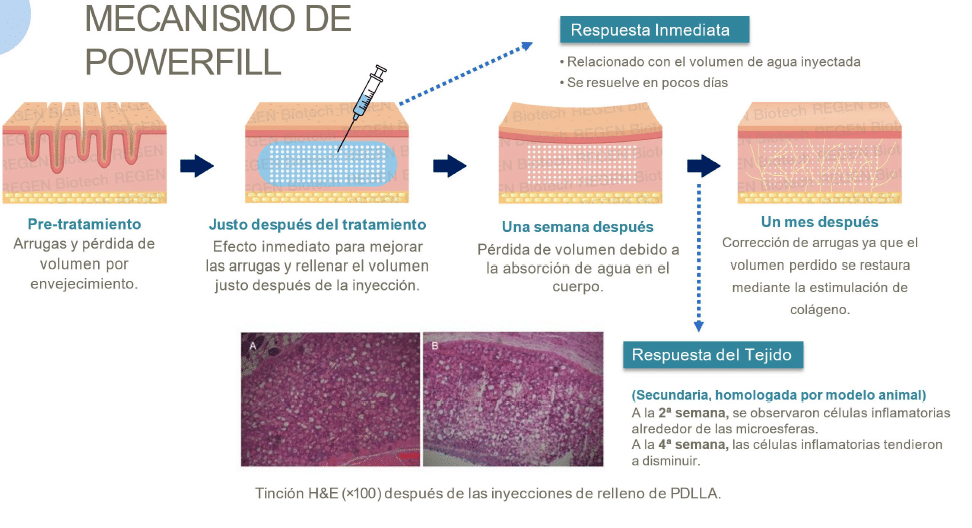 Tratamiento Powerfill Madrid
