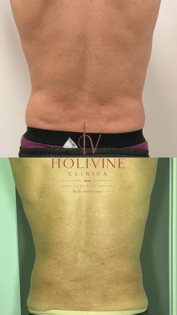 reduccion grasa abdominal hombres